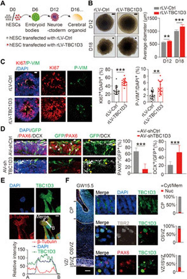 EOMES Antibody in Immunohistochemistry (IHC)