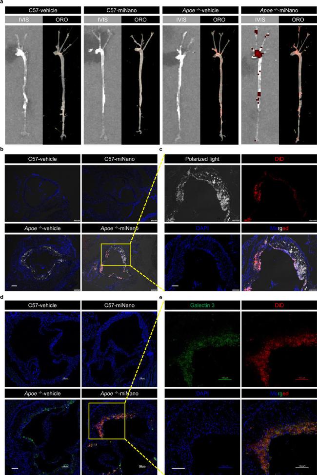 Galectin 3 Antibody in Immunohistochemistry (IHC)