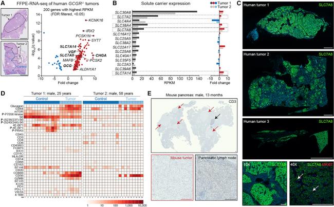 Ki-67 Antibody in Immunohistochemistry (IHC)