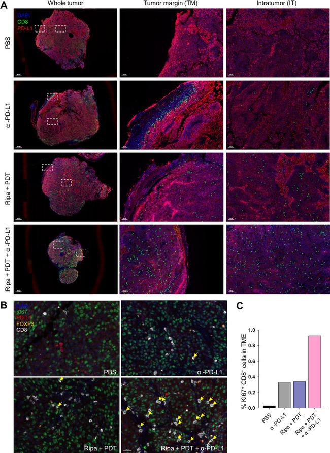 FOXP3 Antibody in Immunohistochemistry (IHC)