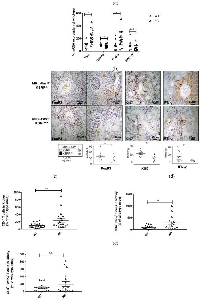 FOXP3 Antibody in Immunohistochemistry (IHC)