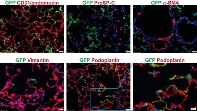 Endomucin Antibody in Immunohistochemistry (IHC)