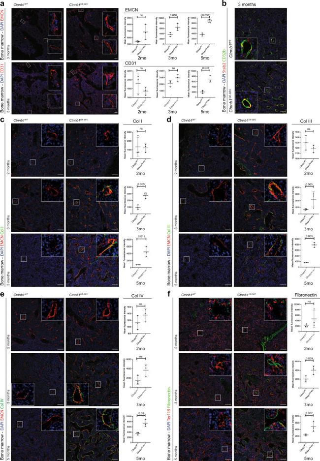 Endomucin Antibody in Immunocytochemistry (ICC/IF)