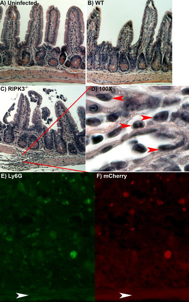 Ly-6G/Ly-6C Antibody in Immunohistochemistry (IHC)