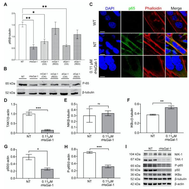 beta Tubulin Loading Control Antibody in Western Blot (WB)