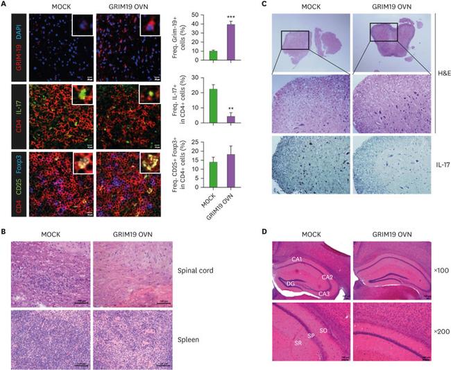 IL-17A Antibody in Immunohistochemistry (IHC)