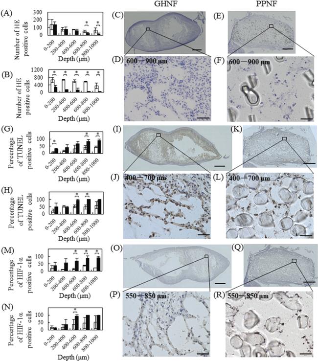 HIF-1 alpha Antibody in Immunohistochemistry (IHC)