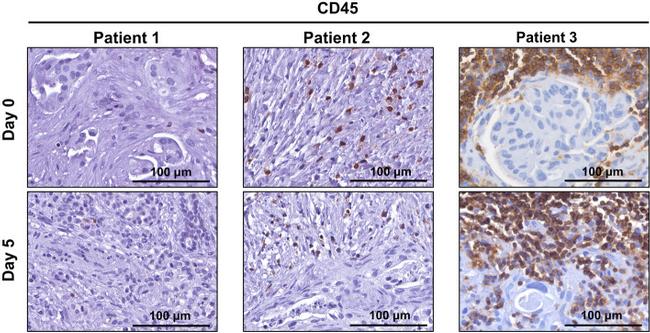 CD45 Antibody in Immunohistochemistry (IHC)