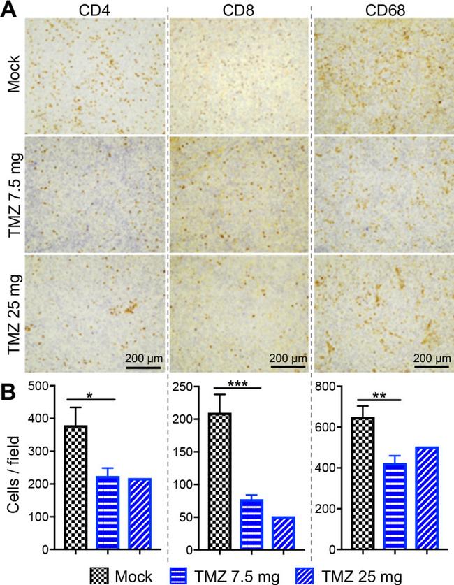 CD4 Antibody in Immunohistochemistry (IHC)