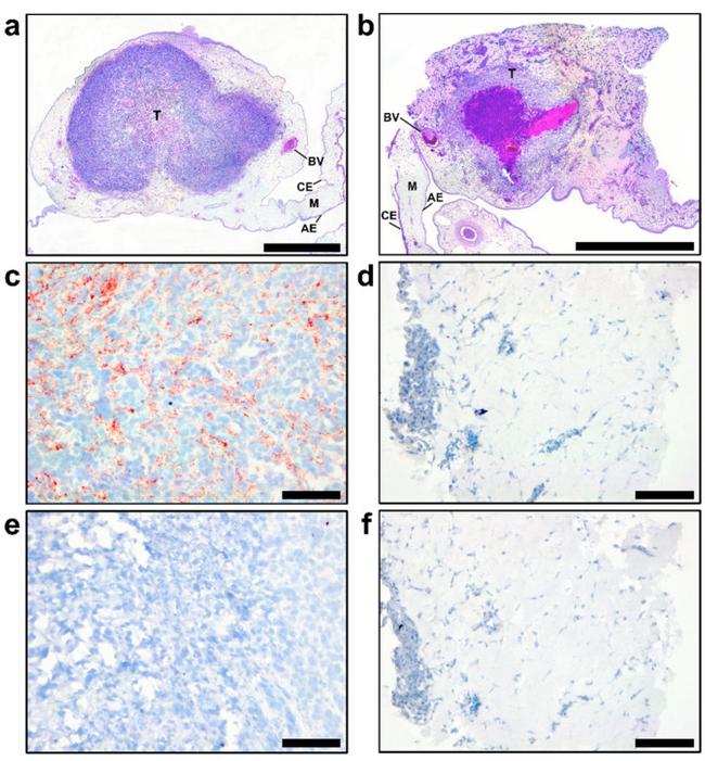 TGM2 Antibody in Immunohistochemistry (IHC)