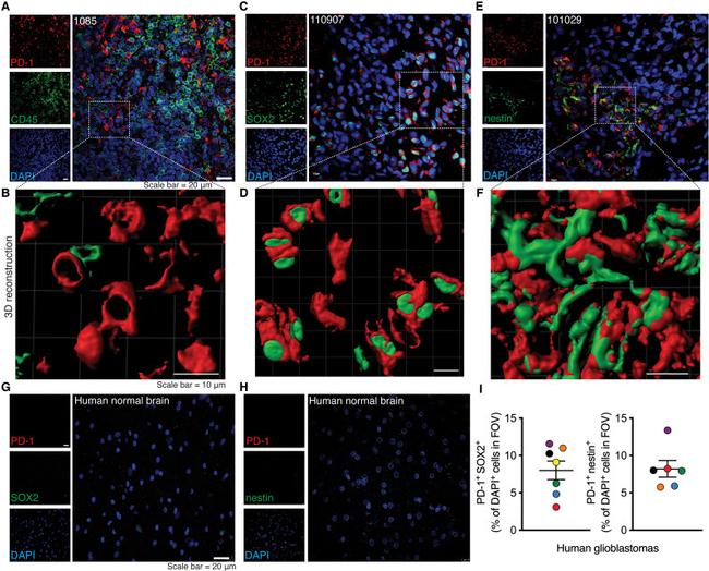 SOX2 Antibody in Immunohistochemistry (IHC)