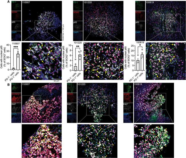 SOX2 Antibody in Immunohistochemistry (IHC)