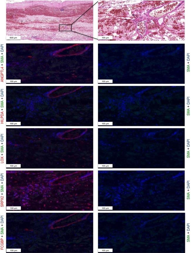 ANGPTL4 Antibody in Immunohistochemistry (IHC)