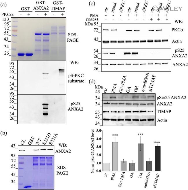 Phospho-Annexin A2 (Ser26) Antibody in Western Blot (WB)