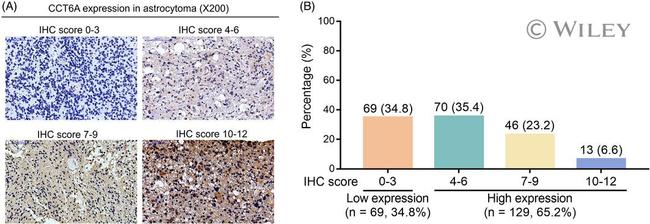 CCT6A Antibody in Immunohistochemistry (IHC)