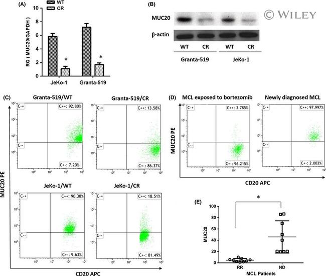 MUC20 Antibody in Western Blot (WB)