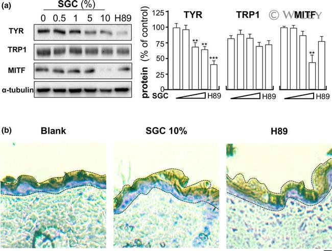 Tyrosinase Antibody in Western Blot (WB)