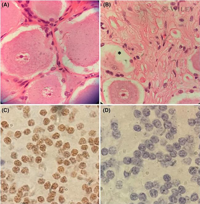 FAM134B Antibody in Immunohistochemistry (IHC)