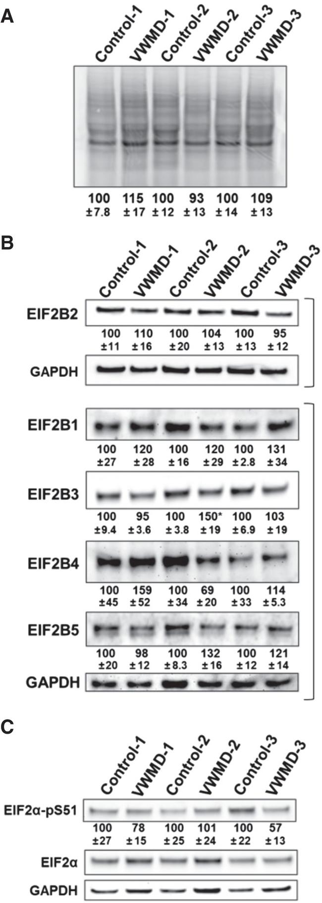 eIF2b alpha Antibody in Western Blot (WB)