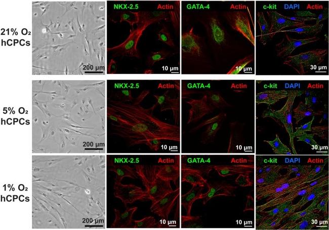 GATA4 Antibody in Immunocytochemistry (ICC/IF)