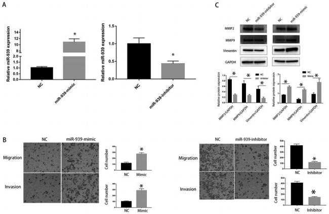 MMP9 Antibody in Western Blot (WB)