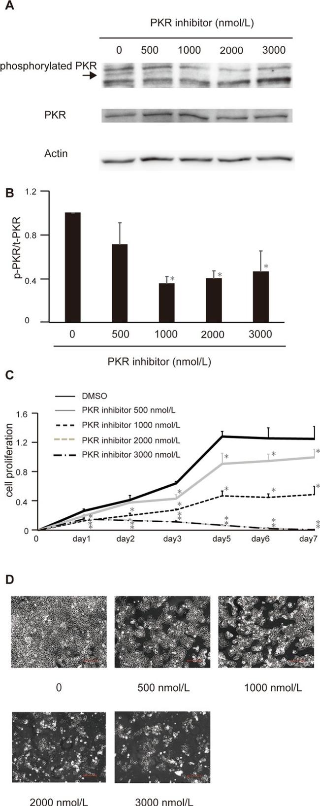 Phospho-PKR (Thr451) Antibody in Western Blot (WB)