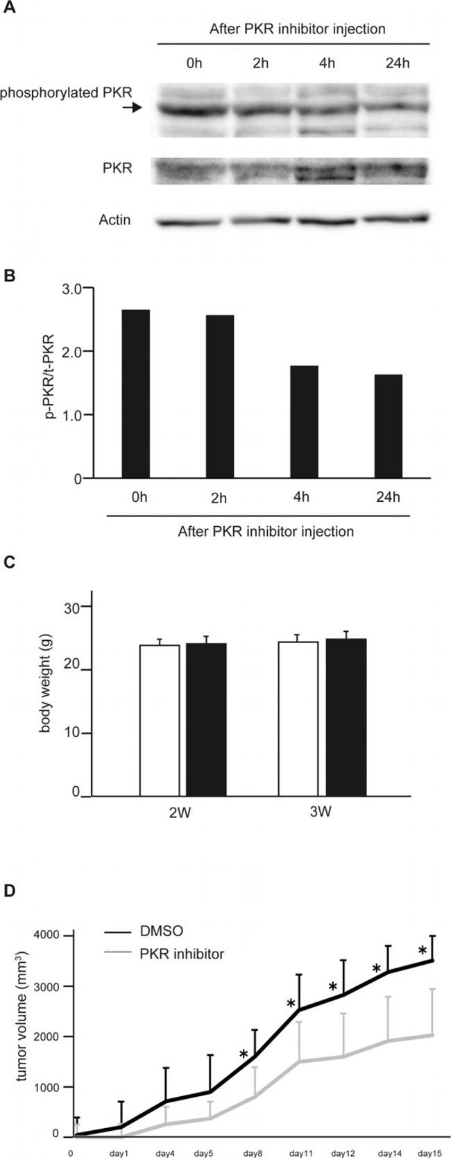 Phospho-PKR (Thr451) Antibody in Western Blot (WB)