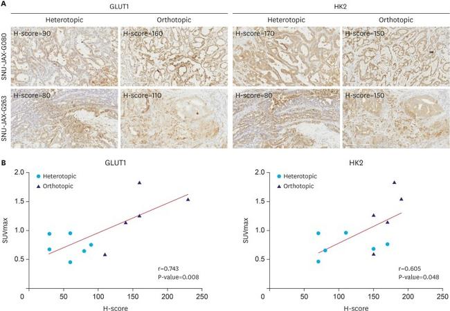 HK2 Antibody in Immunohistochemistry (IHC)