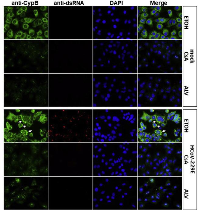 Cyclophilin B Antibody in Immunocytochemistry (ICC/IF)