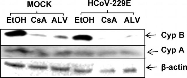 Cyclophilin B Antibody in Western Blot (WB)