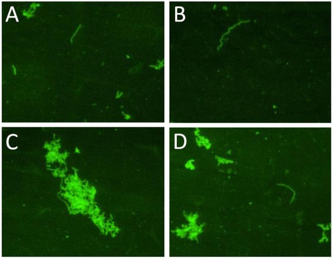 Borrelia burgdorferi Antibody in Immunocytochemistry (ICC/IF)