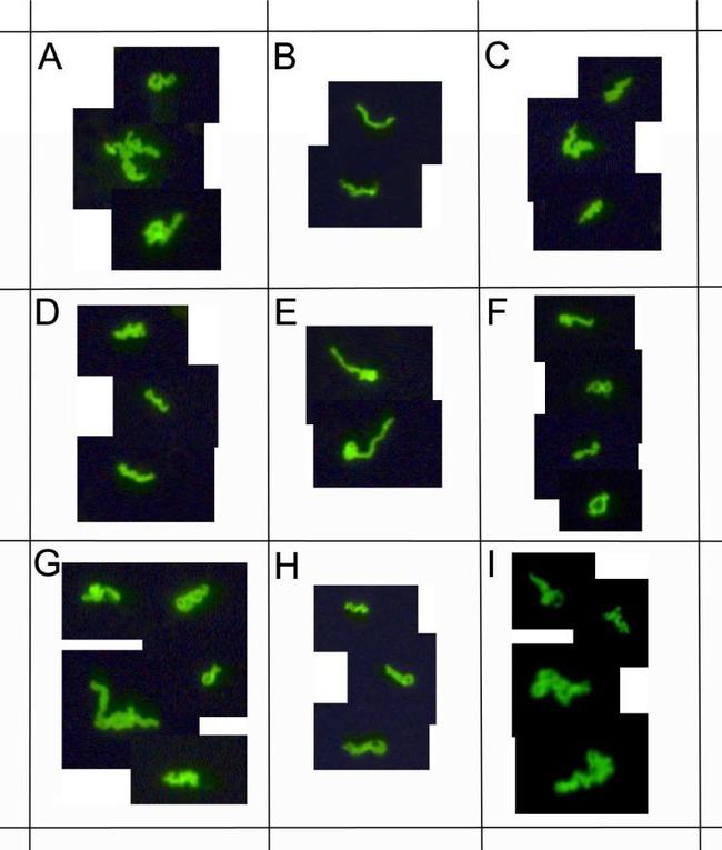 Borrelia burgdorferi Antibody in Immunocytochemistry (ICC/IF)