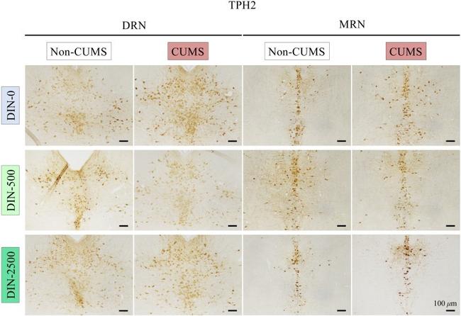 TPH2 Antibody in Immunohistochemistry (IHC)