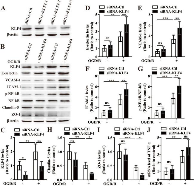 E-selectin Antibody in Western Blot (WB)