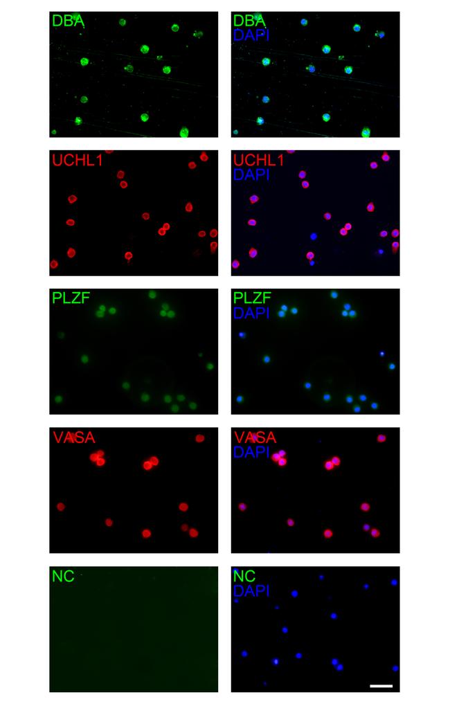 PLZF Antibody in Immunocytochemistry (ICC/IF)