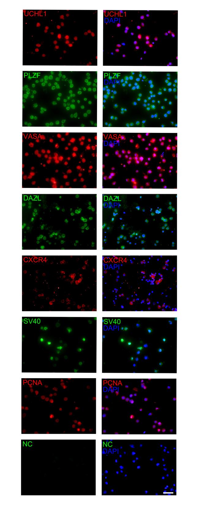 PLZF Antibody in Immunocytochemistry (ICC/IF)