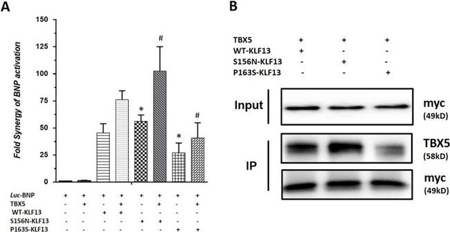 TBX5 Antibody in Western Blot, Immunoprecipitation (WB, IP)