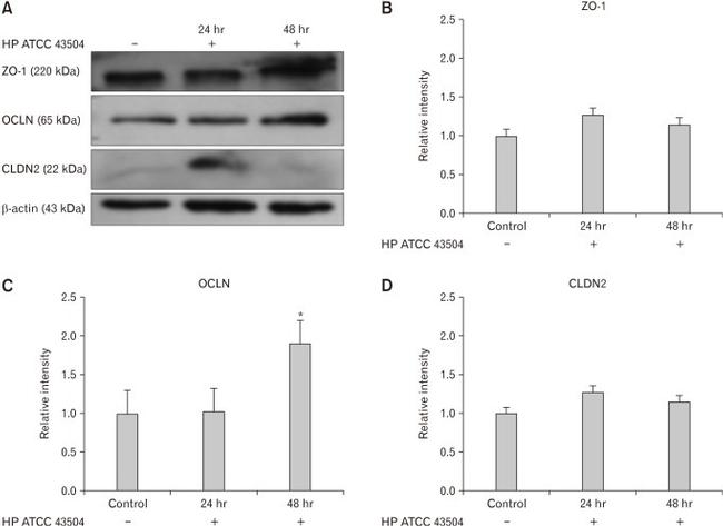 Claudin 2 Antibody in Western Blot (WB)