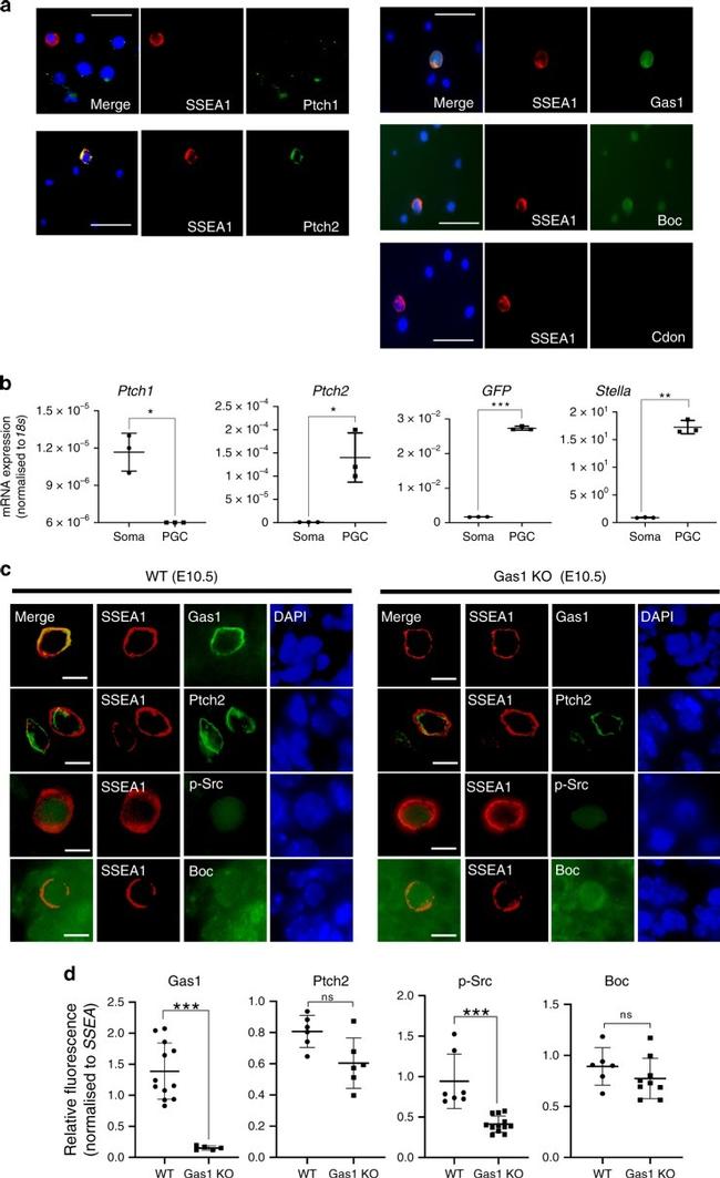 PTCH2 Antibody in Immunocytochemistry (ICC/IF)