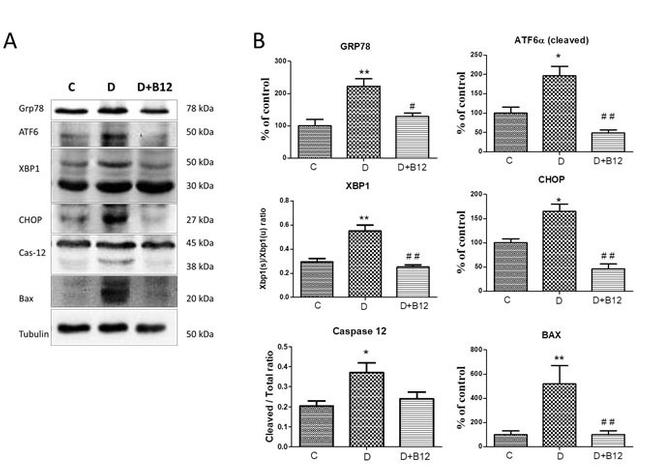 GRP78 Antibody in Western Blot (WB)