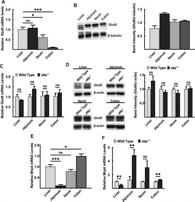 GLUT9 Antibody in Western Blot (WB)