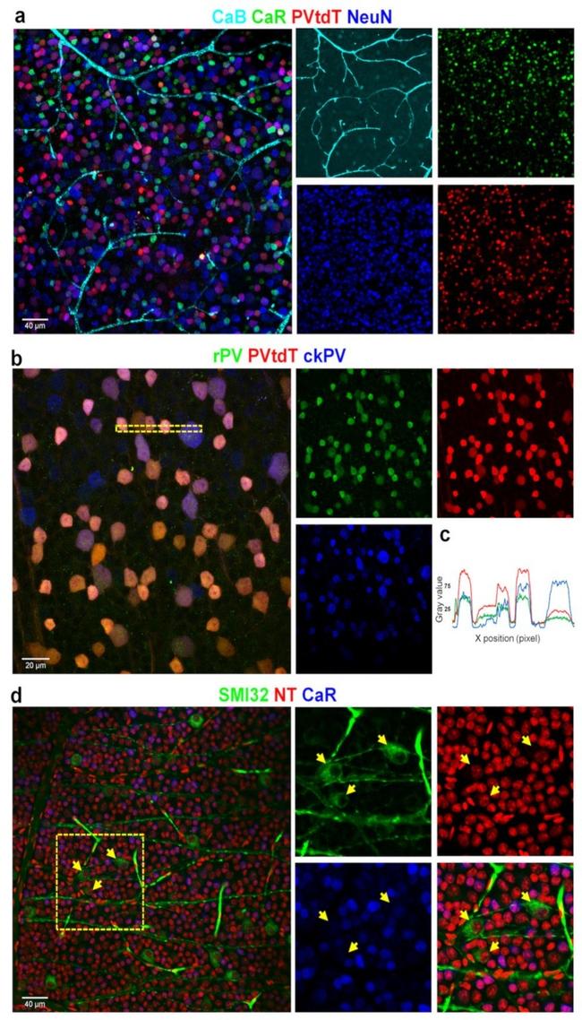 Parvalbumin Antibody in Immunohistochemistry (IHC)