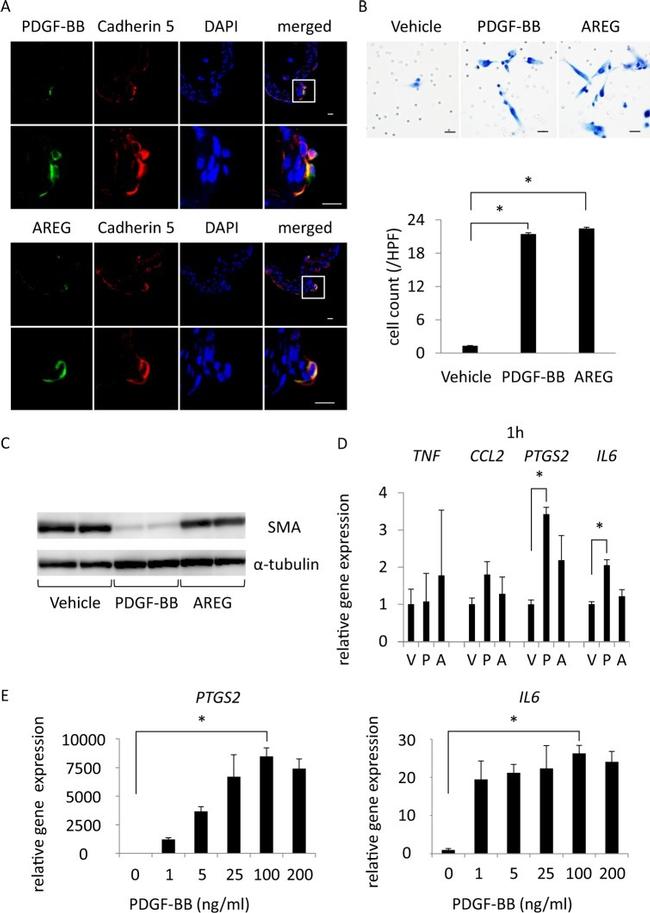 VE-cadherin Antibody in Immunohistochemistry (IHC)