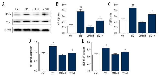 VEGFA Antibody in Western Blot (WB)