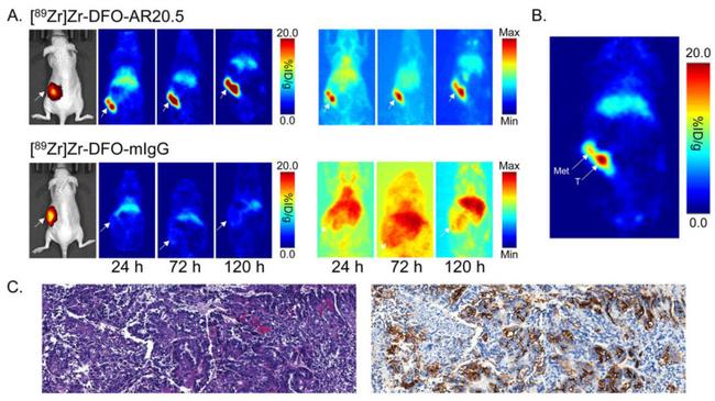 MUC1 Antibody in Immunohistochemistry (IHC)