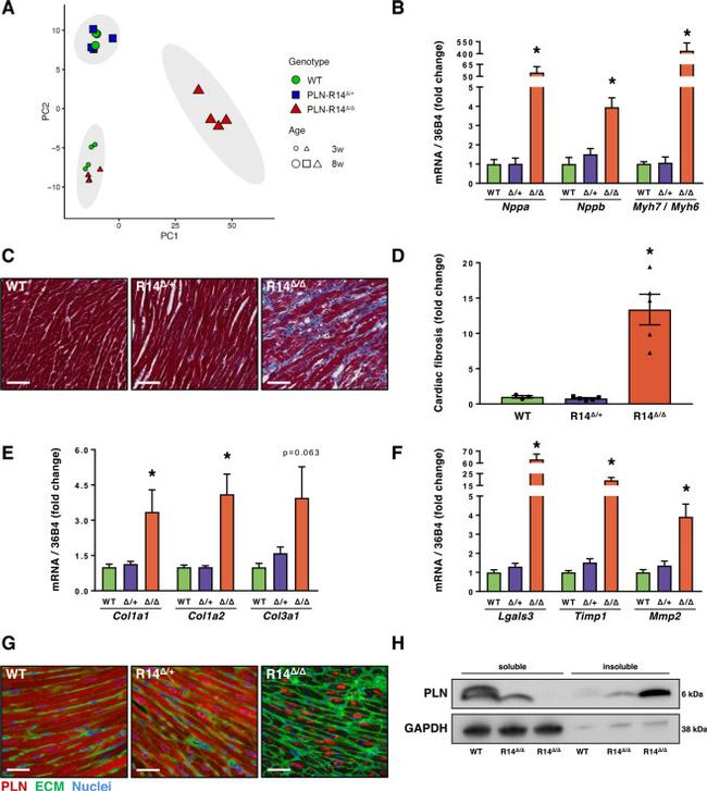 Phospholamban Antibody in Immunohistochemistry (IHC)