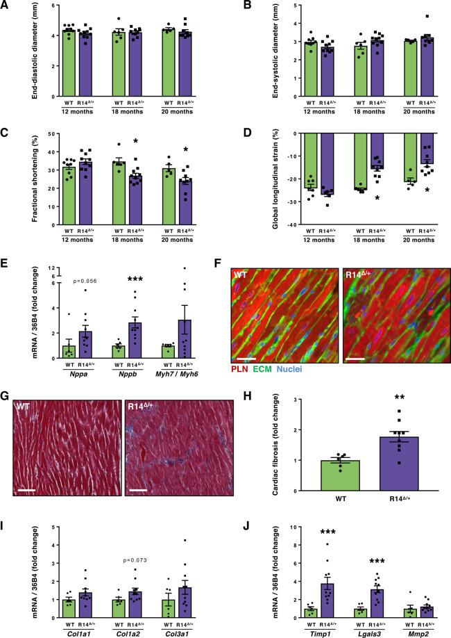 Phospholamban Antibody in Immunohistochemistry (IHC)