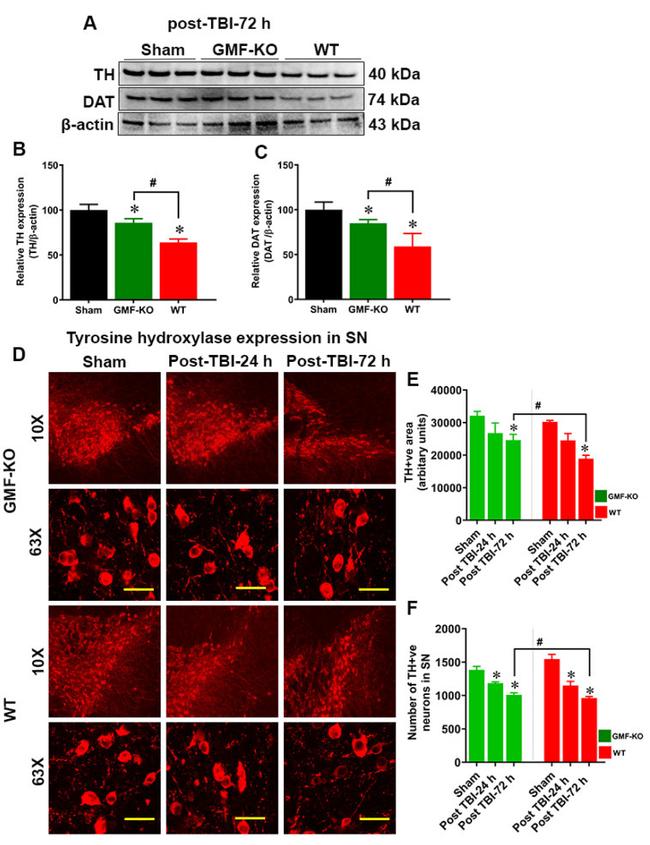 Dopamine Transporter Antibody in Western Blot (WB)