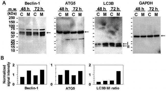 ATG5 Antibody in Western Blot (WB)