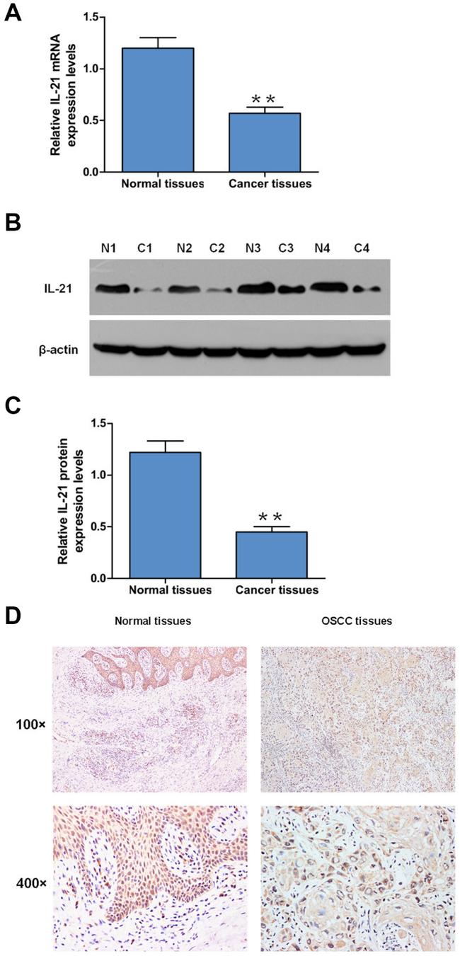 IL-21 Antibody in Western Blot, Immunohistochemistry (WB, IHC)